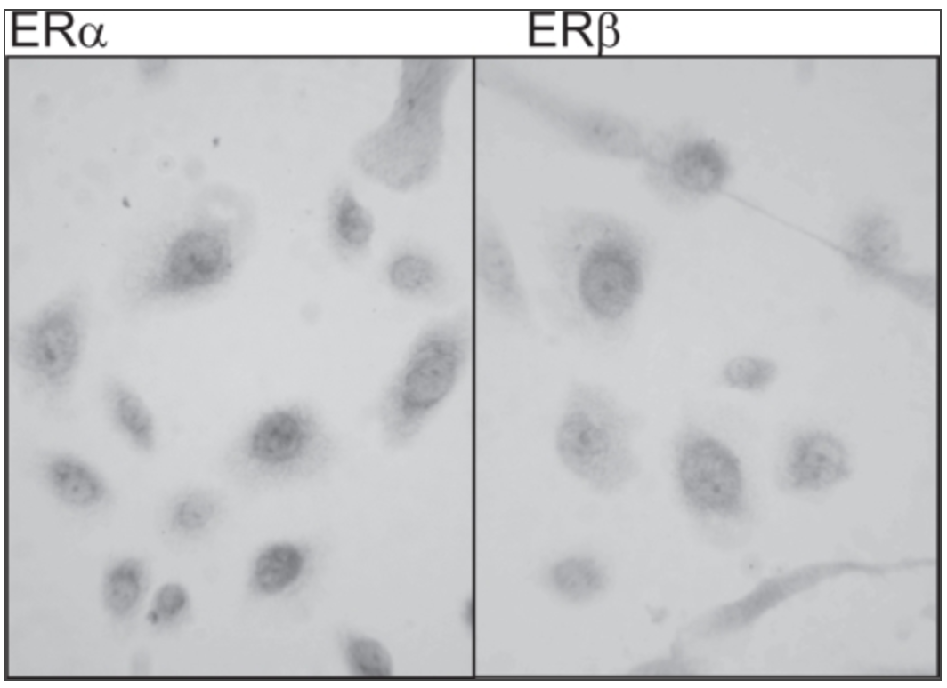 Effect of Estrogens on Skin Aging and the Potential Role of SERMs