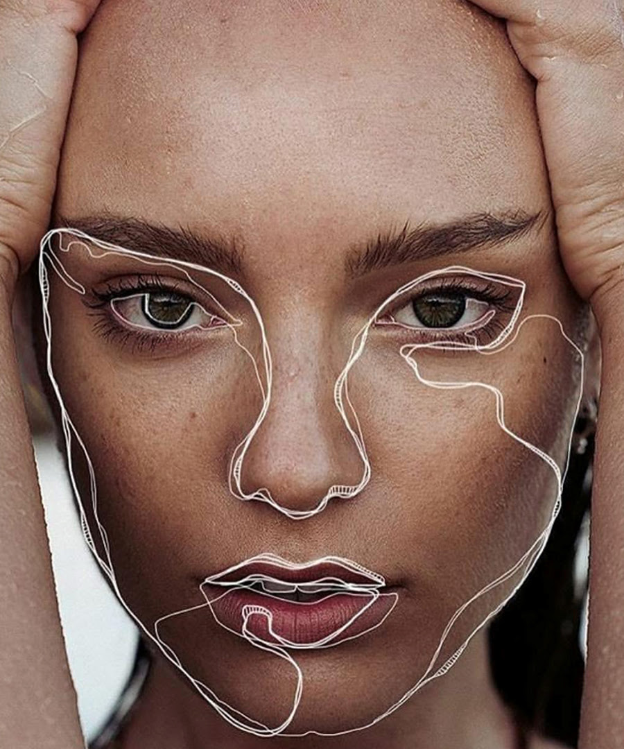 Let’s Face it: Microneedling RF is Revolutionary