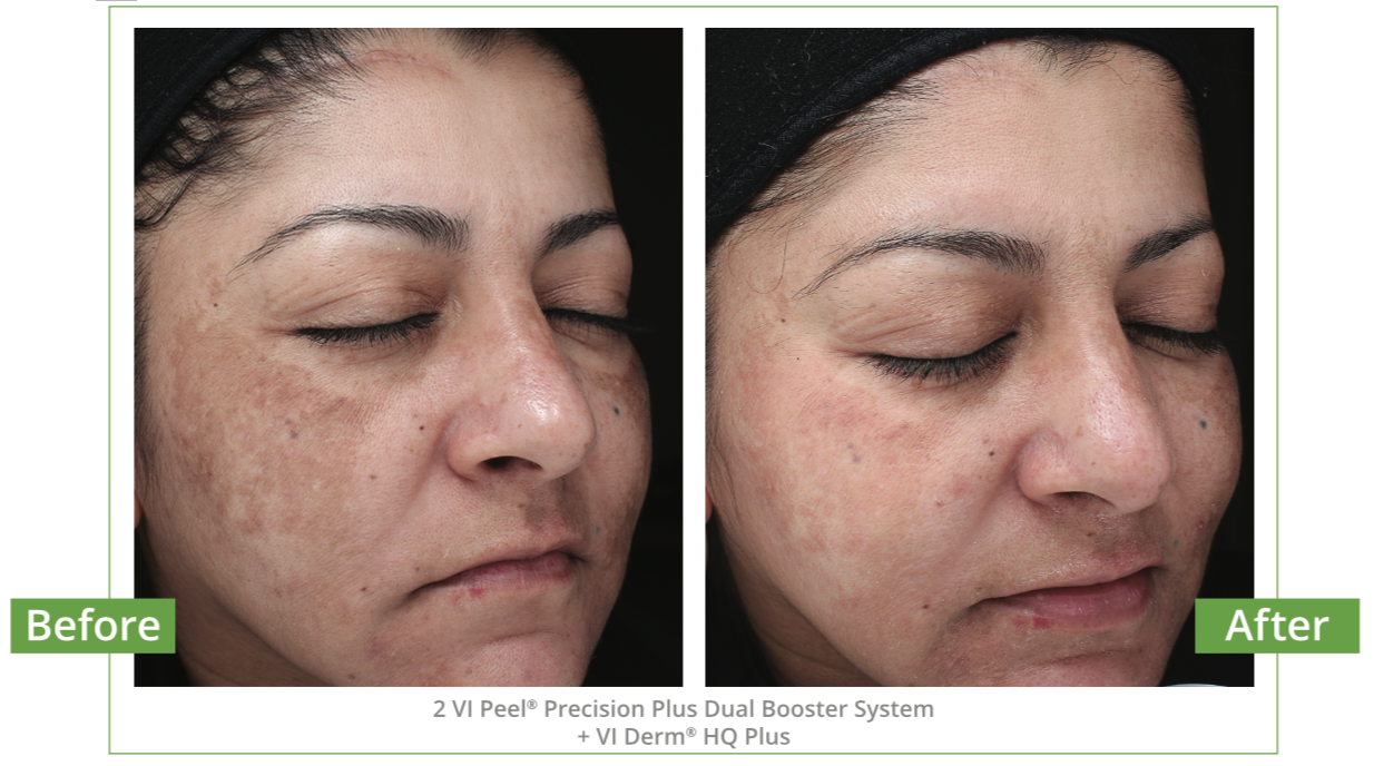 Rediscover Your Skin