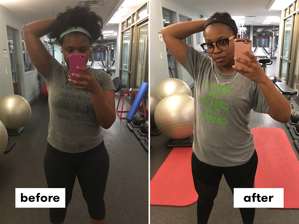 I Tried Botox For Sweating And Haven’t Used Antiperspirant For Months