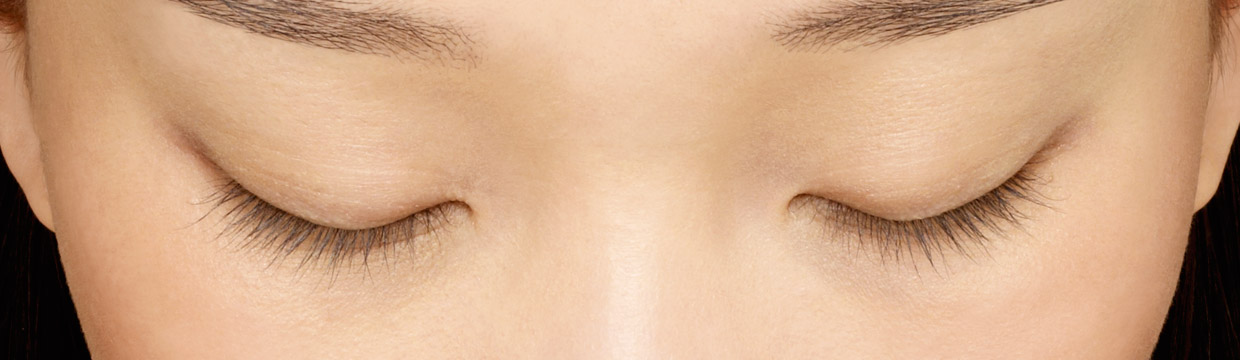 latisse_baseline2